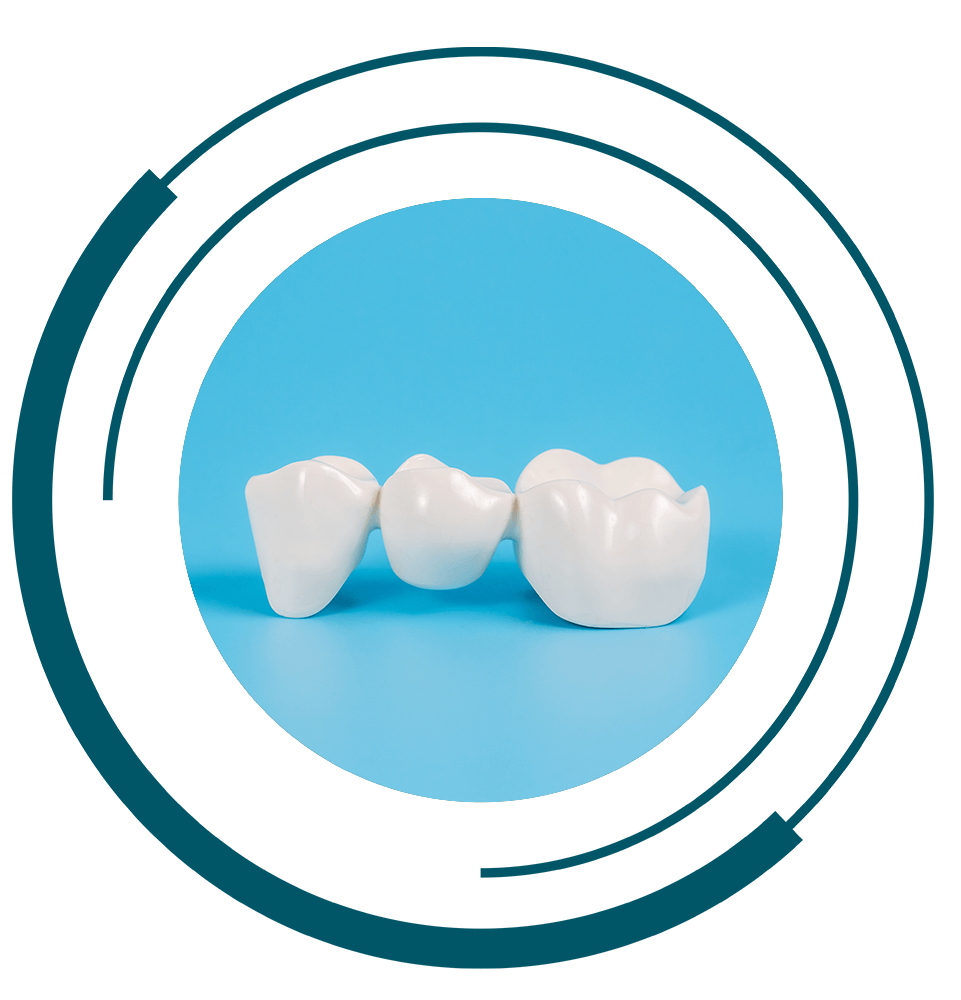 Plastic dental crowns, imitation of a dental prosthesis of a dental bridge