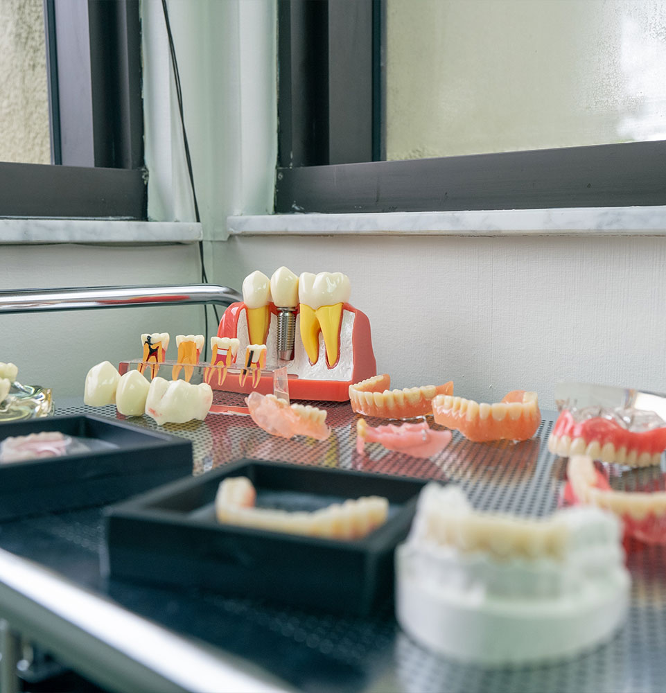 assortment if different implant model within the dental lab